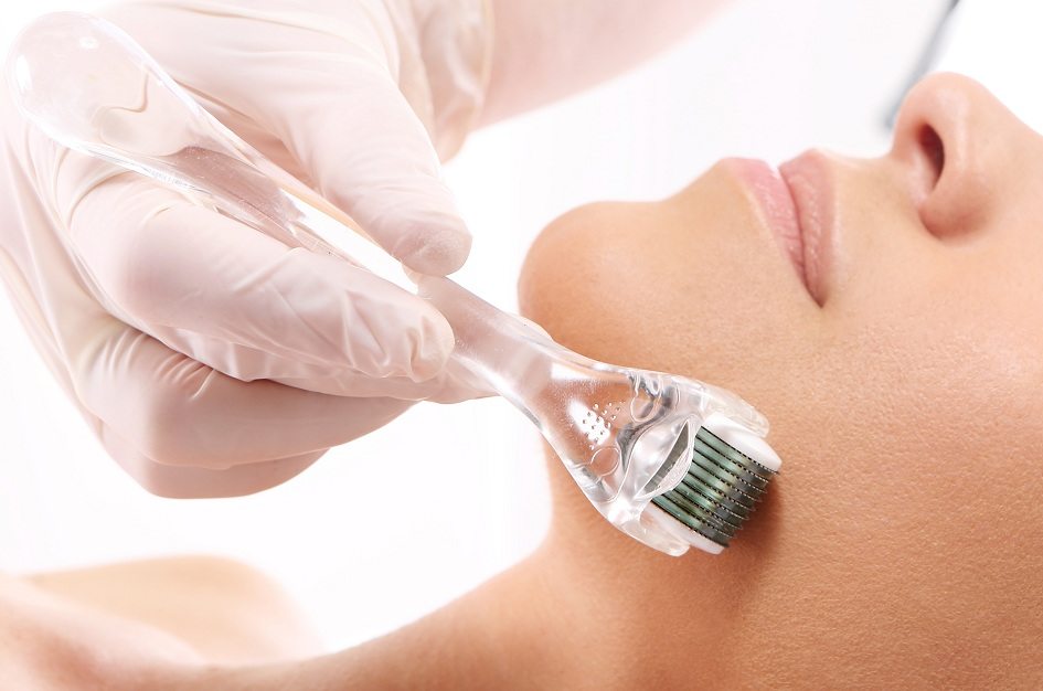 Mulher fazendo microagulhamento